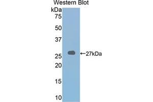Western blot analysis of the recombinant protein. (LOXL2 Antikörper  (AA 553-761))