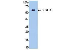 Detection of Recombinant NT5E, Rat using Monoclonal Antibody to Cluster Of Differentiation 73 (CD73) (CD73 Antikörper  (AA 29-550))