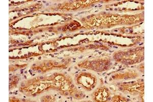 Immunohistochemistry of paraffin-embedded human kidney tissue using ABIN7175933 at dilution of 1:100 (SLC7A7 Antikörper  (AA 325-382))