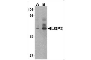 Western blot analysis of LGP2 in rat kidney tissue lysate with this product at (A) 1 and (B) 2 μg/ml. (DHX58 Antikörper  (C-Term))