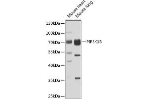 Western blot analysis of extracts of various cell lines, using PIP5K1B antibody (ABIN6130645, ABIN6145684, ABIN6145686 and ABIN6223693) at 1:1000 dilution. (PIP5K1B Antikörper  (AA 190-470))