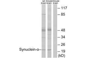 Western blot analysis of extracts from rat brain and mouse brain, using Synuclein-α (Ab-125) antibody. (SNCA Antikörper  (Tyr125))