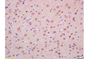 Formalin-fixed and paraffin embedded rat brain labeled with Anti-RASSF2 Polyclonal Antibody, Unconjugated (ABIN681988) at 1:200 followed by conjugation to the secondary antibody and DAB staining. (RASSF2 Antikörper  (AA 201-300))