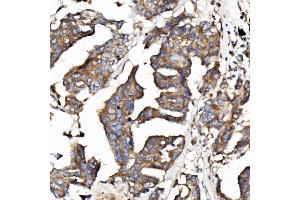 IHC analysis of EPB41L5 using anti-EPB41L5 antibody (ABIN7601550).
