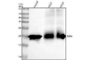 Western blot analysis of RBP4 using anti-RBP4 antibody (ABIN7606153).