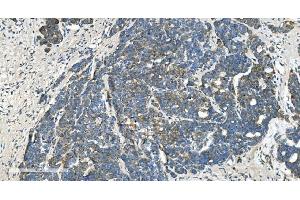 IHC analysis of TIMM8A/DDP using anti-TIMM8A/DDP antibody (ABIN7600039). (TIMM8A/DDP Antikörper  (AA 14-97))