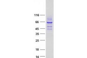 Validation with Western Blot (Rhotekin Protein (RTKN) (Transcript Variant 1) (Myc-DYKDDDDK Tag))