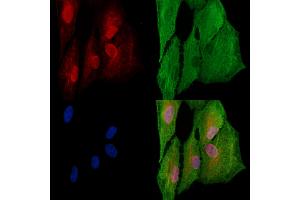 ABIN6264002 and ABIN6277554 staining  cells by IF/ICC. (PA2G4 Antikörper  (C-Term))