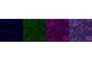 Immunohistochemistry (IHC) image for anti-Cellular Retinoic Acid Binding Protein 1 (CRABP1) antibody (ABIN7456170)