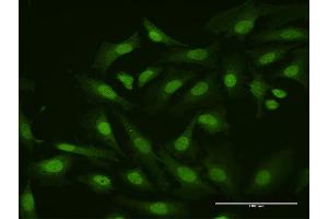 Immunofluorescence of purified MaxPab antibody to HHEX on HeLa cell. (HHEX Antikörper  (AA 1-270))
