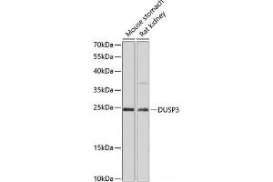 Western blot analysis of extracts of various cell lines using DUSP3 Polyclonal Antibody at dilution of 1:3000. (Dual Specificity Phosphatase 3 (DUSP3) Antikörper)