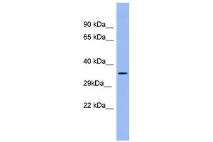 WB Suggested Anti-PSG5 Antibody Titration:  0. (PSG5 Antikörper  (Middle Region))