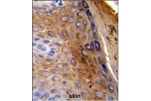 Formalin-fixed and paraffin-embedded human skin reacted with KRT10 Antibody (Center), which was peroxidase-conjugated to the secondary antibody, followed by DAB staining. (Keratin 10 Antikörper  (AA 318-346))