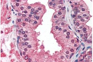 Prostate: Formalin-Fixed, Paraffin-Embedded (FFPE) (IGF1R Antikörper)