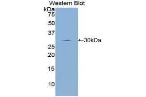 Western blot analysis of the recombinant protein. (Dopamine d2 Receptor Antikörper  (AA 194-421))