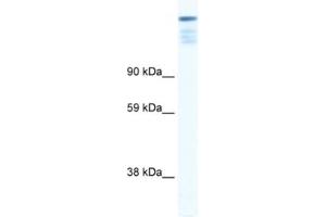 Western Blotting (WB) image for anti-Zinc Finger Protein 106 Homolog (ZFP106) antibody (ABIN2460682) (ZFP106 Antikörper)