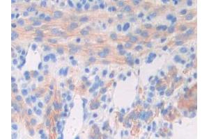 IHC-P analysis of Mouse Uterus Tissue, with DAB staining. (GAD Antikörper  (AA 1-97))