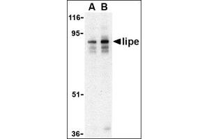 Western blot analysis of lipe in human lymph node tissue lysate with this product at (A) 0. (LIPE Antikörper  (C-Term))