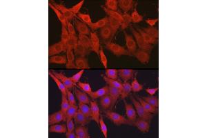 Immunofluorescence analysis of PC-12 cells using Galectin 1/LG Rabbit pAb (ABIN6130424, ABIN6143156, ABIN6143157 and ABIN6218649) at dilution of 1:50 (40x lens). (LGALS1/Galectin 1 Antikörper  (AA 1-135))