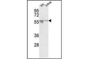 Western blot analysis of CDKL2 antibody (Center) in 293, Jurkat cell line lysates (35ug/lane). (CDKL2 Antikörper  (AA 233-263))