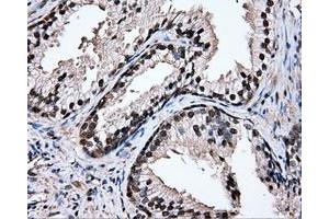 Immunohistochemical staining of paraffin-embedded prostate tissue using anti-TIPRLmouse monoclonal antibody.