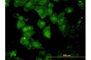 Immunofluorescence of monoclonal antibody to GCLC on HeLa cell. (GCLC Antikörper  (AA 528-637))