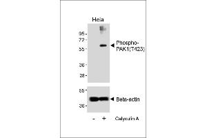 Western blot analysis of lysates from Hela cell line, untreated or treated with EGF(1 μg/mL, 10 min), using Phospho-K1 Antibody (upper) or Beta-actin (lower). (PAK1 Antikörper  (pThr423))