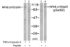 Image no. 2 for anti-Nuclear Factor of kappa Light Polypeptide Gene Enhancer in B-Cells 1 (NFKB1) (pSer932) antibody (ABIN197008) (NFKB1 Antikörper  (pSer932))