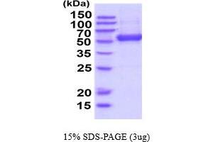 ENTPD3 Protein (AA 44-485) (His tag)