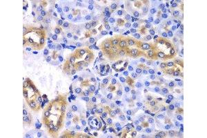 Immunohistochemistry of paraffin-embedded Mouse kidney using SYNCRIP Polyclonal Antibody at dilution of 1:100 (40x lens). (SYNCRIP Antikörper)