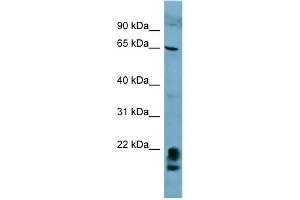 WB Suggested Anti-FAM134A Antibody Titration:  0. (FAM134A Antikörper  (N-Term))