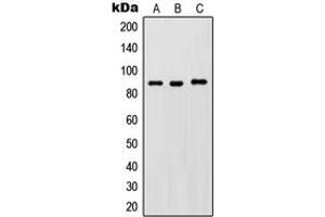 Western blot analysis of IKK beta (pY188) expression in HeLa LPS-treated (A), Raw264. (IKBKB Antikörper  (pTyr188))