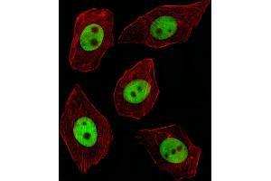 Immunofluorescence (IF) image for anti-General Transcription Factor III (GTF2I) (AA 956-985), (C-Term) antibody (ABIN390868)
