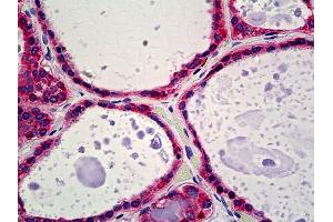 Anti-Calreticulin antibody IHC of human thyroid.