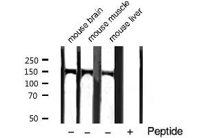 Western blot analysis of extracts of various tissue sample,using Phospho-PLCG1 (Tyr771) Antibody. (Phospholipase C gamma 1 Antikörper  (pTyr771))
