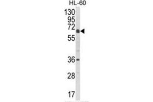 Western blot analysis of CYP2C18 Antibody (C-term) in HL-60 cell line lysates (35ug/lane). (CYP2C18 Antikörper  (C-Term))
