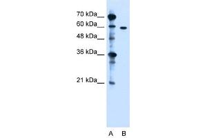 ZDHHC13 antibody used at 1.