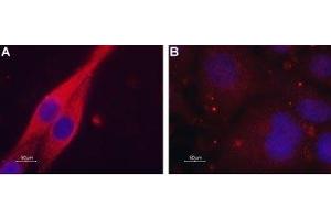 Expression of Muscarinic acetylcholine receptor M4 in C6 transfected cells - Immunocytochemical staining of paraformaldehyde-fixed and permeabilized C6 cells. (CHRM4 Antikörper  (AA 330-340))