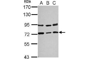WB Image Sample (30 ug of whole cell lysate) A: NT2D1 B: PC-3 C: U87-MG 7. (NGFR Antikörper)