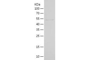 Choline Acetyltransferase Protein (AA 323-575) (His-IF2DI Tag)