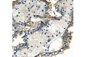 IHC analysis of SLC2A9 using anti-SLC2A9 antibody (ABIN7602338).