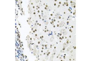 Immunohistochemistry of paraffin-embedded mouse brain using MCL1 antibody at dilution of 1:100 (x40 lens). (MCL-1 Antikörper)