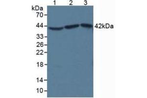 SDS-PAGE of Protein Standard from the Kit (Highly purified E. (beta Actin ELISA Kit)
