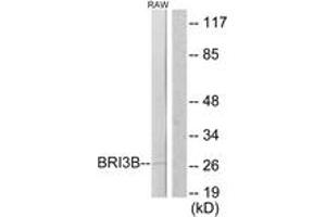 Western Blotting (WB) image for anti-BRI3 Binding Protein (BRI3BP) (AA 1-50) antibody (ABIN2879158) (BRI3BP Antikörper  (AA 1-50))