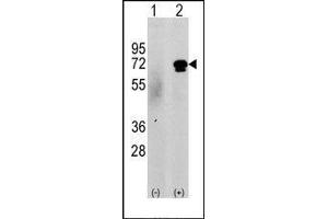 Western blot analysis of CAMKK2 (arrow) using rabbit polyclonal CAMKK2 Antibody (CAMKK2 Antikörper  (N-Term))