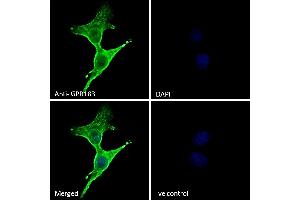 (ABIN768598) Immunofluorescence analysis of paraformaldehyde fixed A431 cells, permeabilized with 0. (GPR183 Antikörper  (Internal Region))