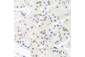 Immunohistochemistry of paraffin-embedded human stomach using HMGN1 antibody (ABIN5975005) at dilution of 1/100 (40x lens). (HMGN1 Antikörper)