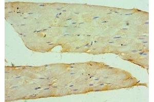 Immunohistochemistry of paraffin-embedded human skeletal muscle tissue using ABIN7149059 at dilution of 1:100 (KAT14 Antikörper  (AA 523-782))