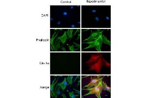 Immunostaining of human retinal endothelial cells. (GLO1 Antikörper)
