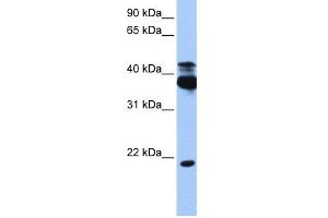 WB Suggested Anti-STK38 Antibody Titration:  0. (STK38 Antikörper  (C-Term))
